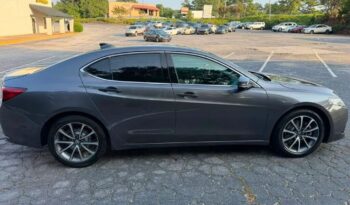 
										2017 Acura TLX full									
